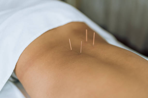 L’acupuncture peut-elle traiter les douleurs chroniques sans effets secondaires ? post thumbnail image